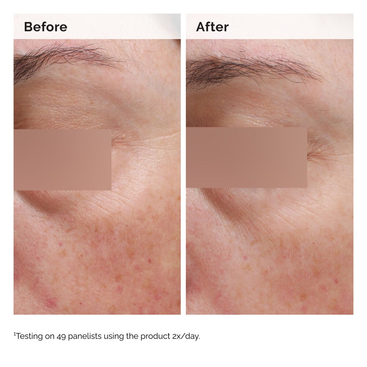 niacinamide-5-face-and-body-emulsion-x6 2024-08-23-ORD-Nia-5pct-Face-Body-B-A-Elasticity-Global-02-1x1.jpg