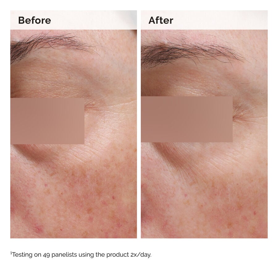 niacinamide-5-face-and-body-emulsion-x6 2024-08-23-ORD-Nia-5pct-Face-Body-B-A-Elasticity-Global-02-1x1.jpg