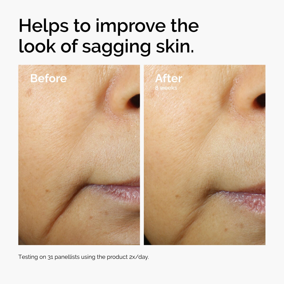 caffeine-3-escin-1-face-serum-i7 ord-caffeine-3pct-escin-1pct-face-serum-before-after-sagging.jpg