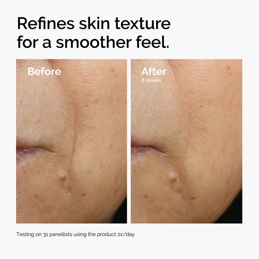 caffeine-3-escin-1-face-serum-i7 ord-caffeine-3pct-escin-1pct-face-serum-before-after-texture.jpg