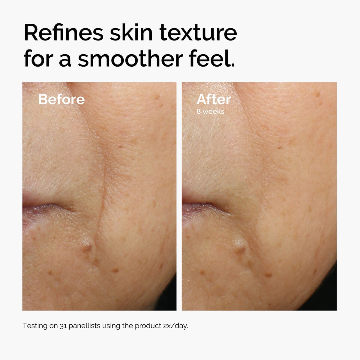 caffeine-3-escin-1-face-serum-i7 ord-caffeine-3pct-escin-1pct-face-serum-before-after-texture.jpg