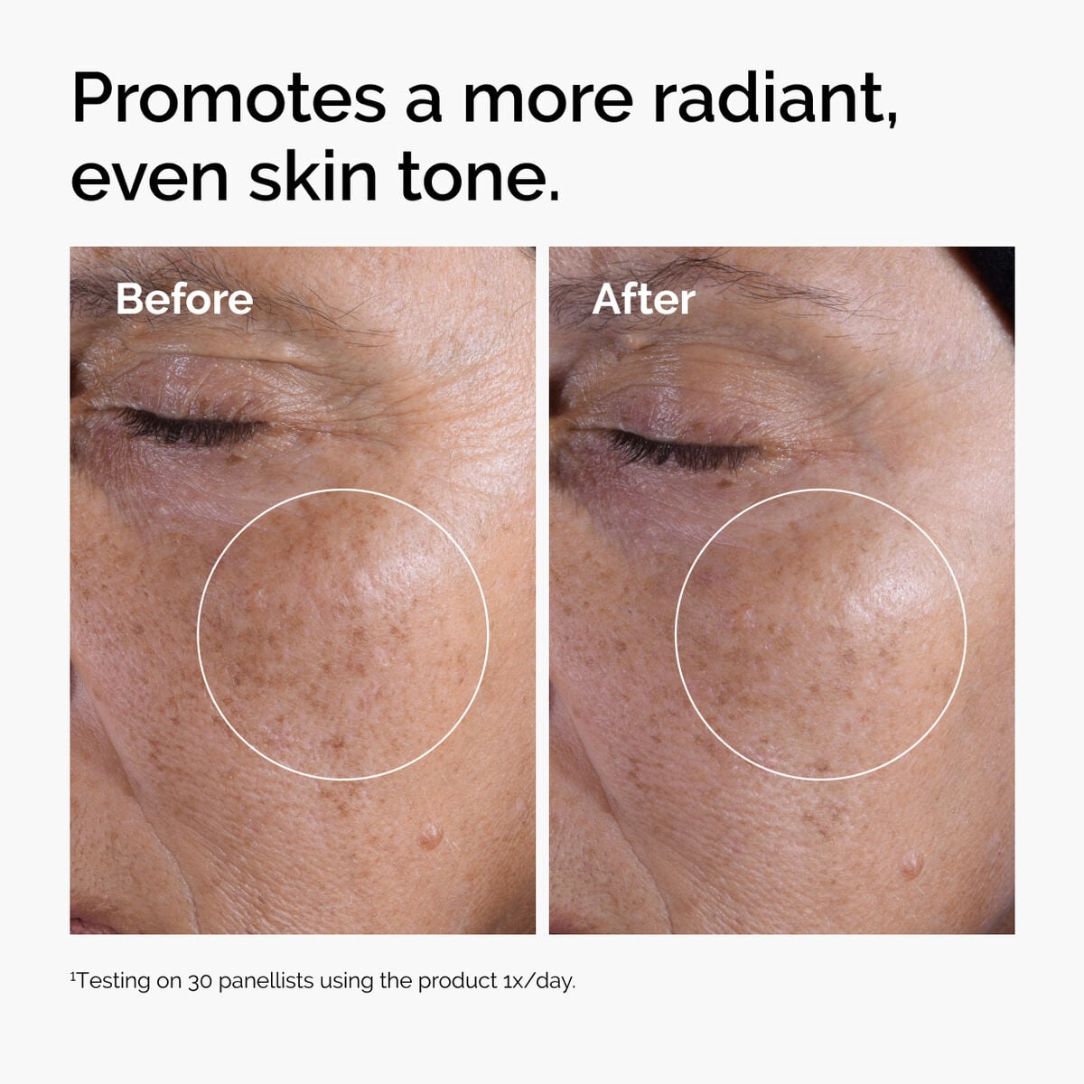 glycolic-acid-7-exfoliating-toner-p8 ord-glycolic-before-after-radiance.jpg
