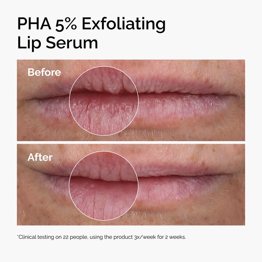 pha-5-exfoliating-lip-serum-r3 ord-pha-5pct-lip-exfoliating-serum-before-after.jpg